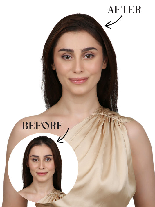 Seamless 2 clip Cover Up Patch