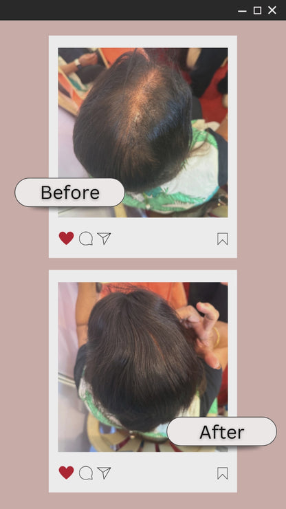 Seamless 2 clip Cover Up Patch